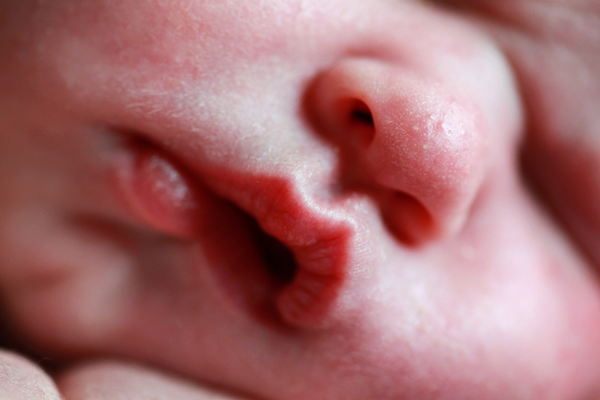 ぜいたく 新生児 唇 乾燥 画像ブログ